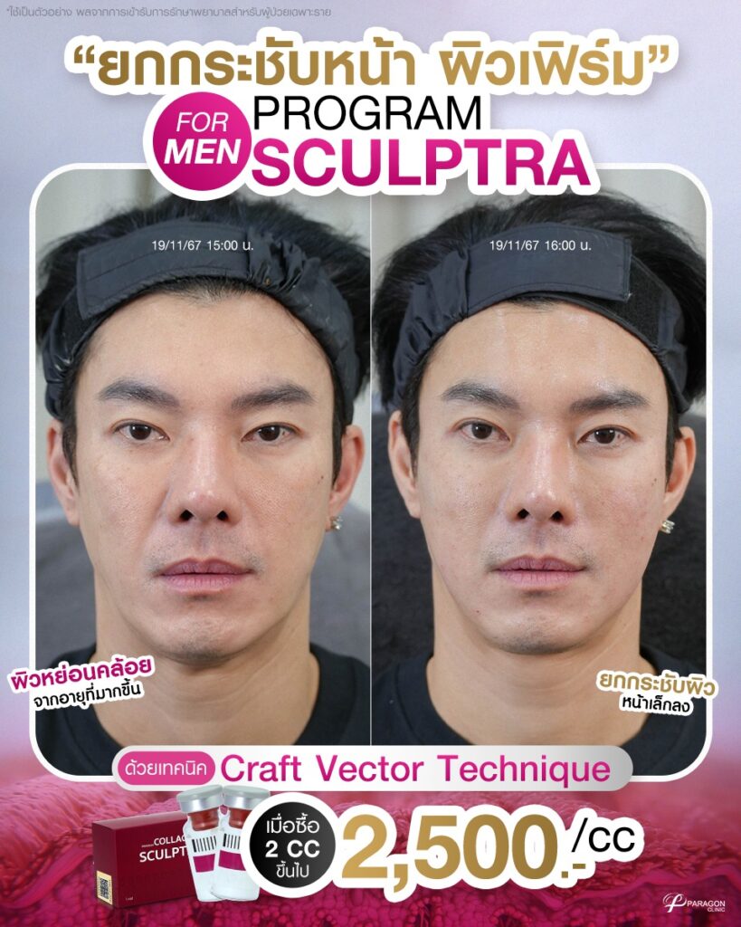 Young Reset+ ลด 28%