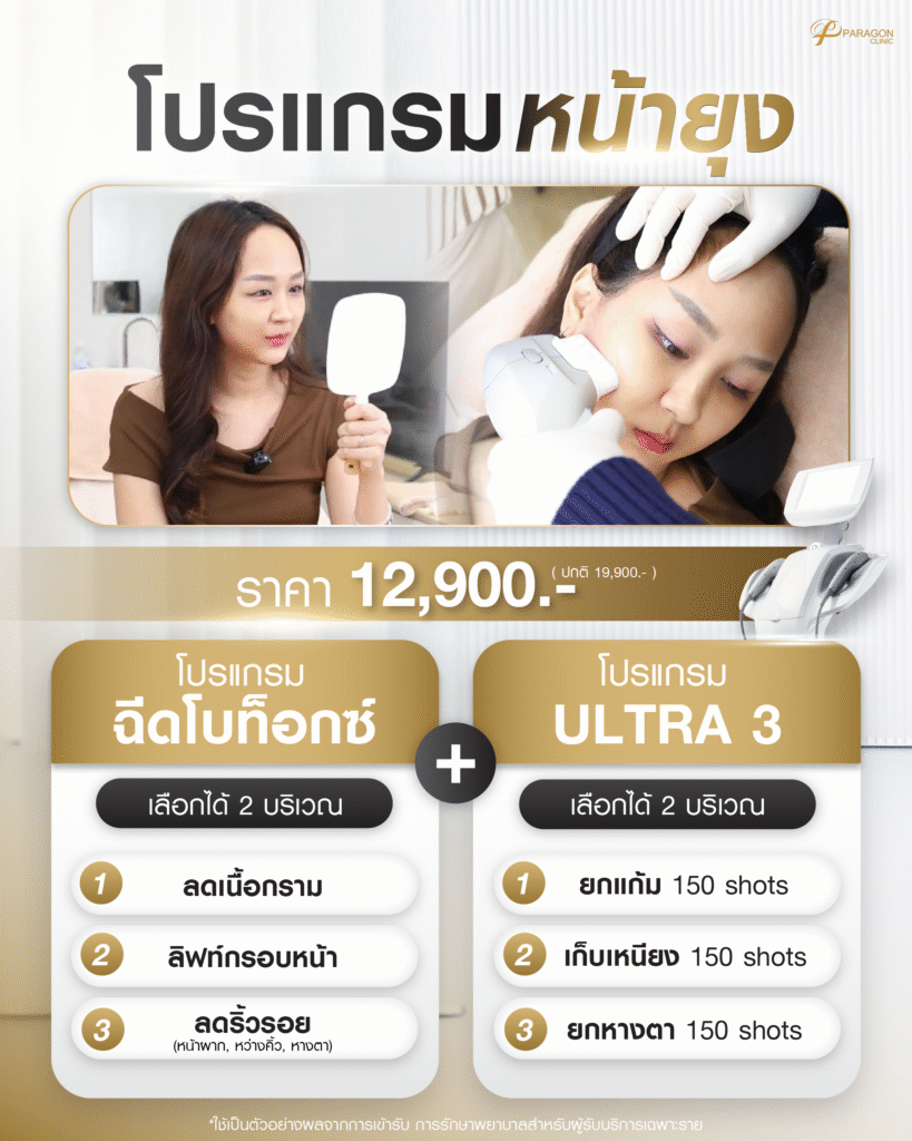 Sculptra ปลุกคอลลาเจน ลด 29%