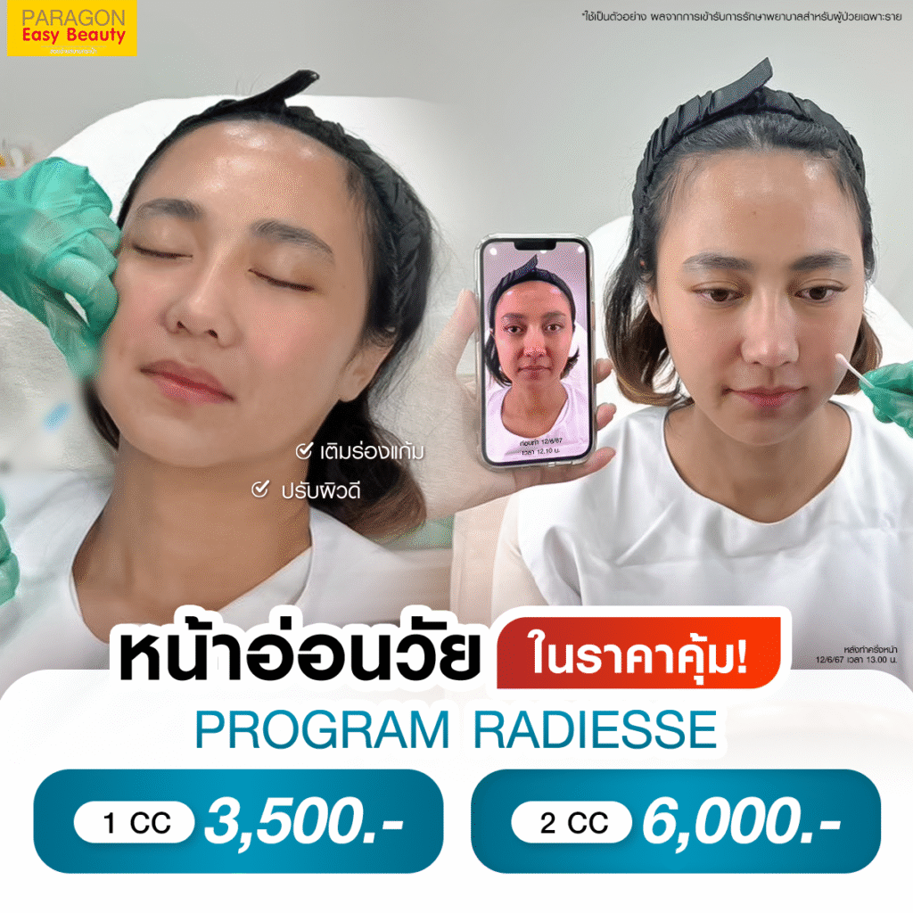 Young Reset+ ลด 28%